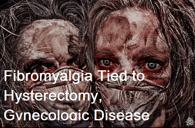 Fibromyalgia Tied to Hysterectomy, Gynecologic Disease