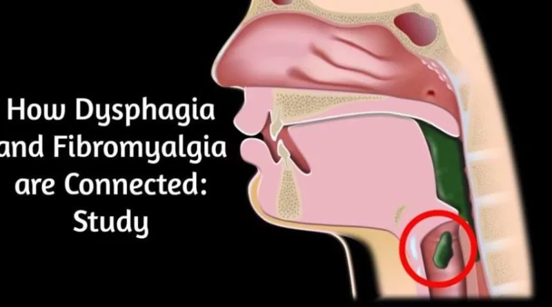 How Dysphagia and Fibromyalgia are Connected