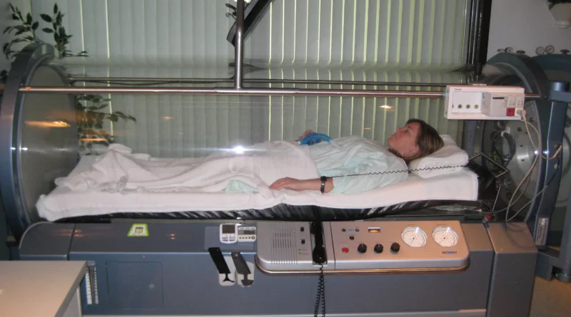 Hyperbaric Oxygen Tanks Found To Treat Fibromyalgia