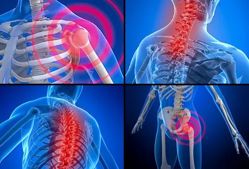 43 Symptoms of Fibromyalgia – Anyone With Muscle Pain Should Read This