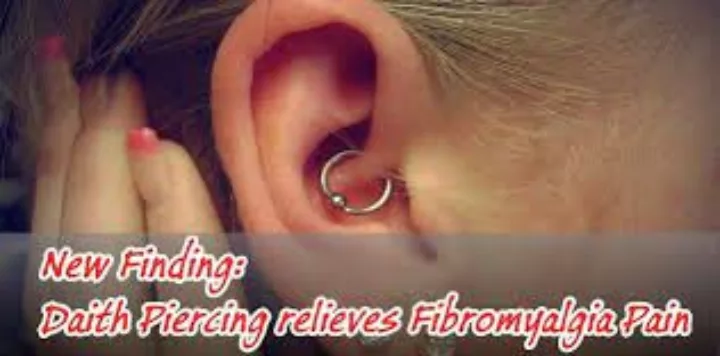 New Finding: New Daith Piercing relieves CM & Fibromyalgia Flares