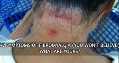 72 Symptoms of Fibromyalgia (Hard to Believe). What are yours?