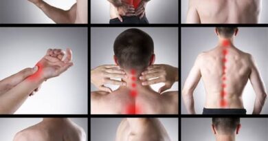 Fibromyalgia symptoms can vary but often include: